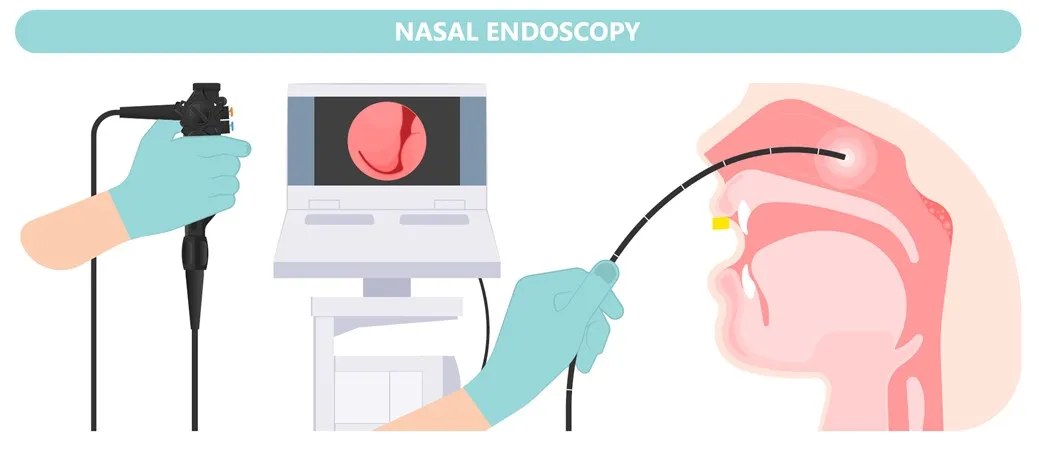 nasal endoscopy