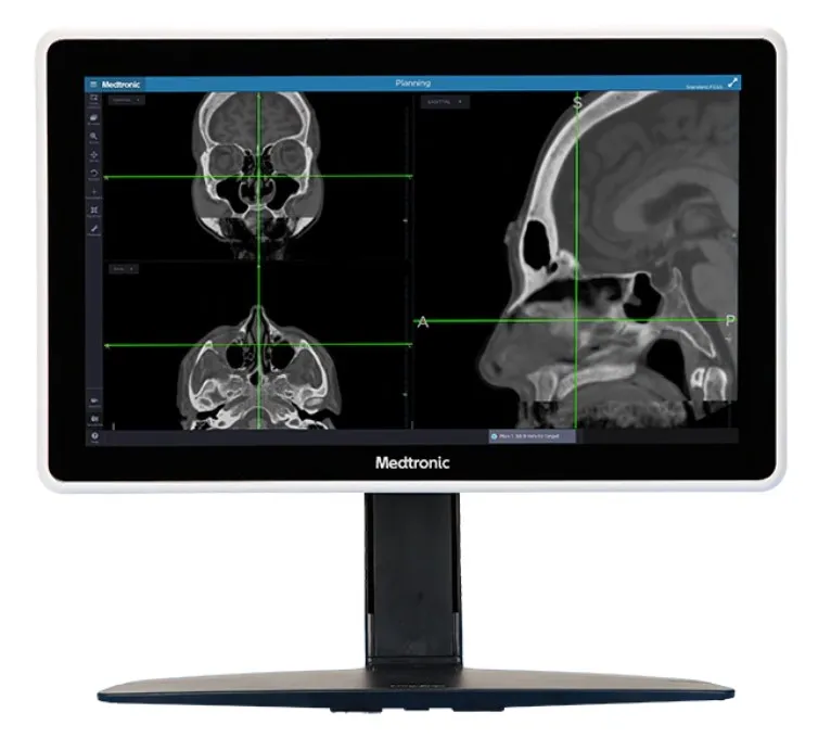 sinuplasty scan